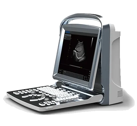 УЗИ аппарат Chison ECO 1