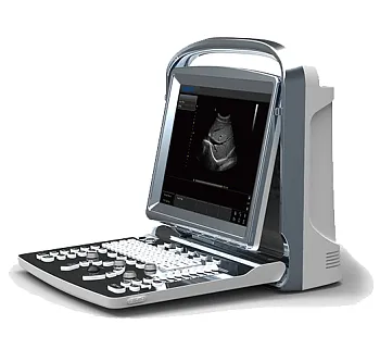 УЗИ аппарат Chison ECO 1
