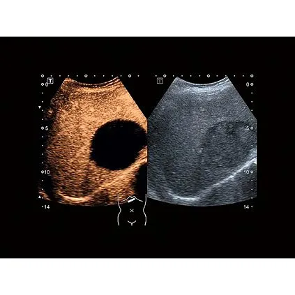 Клинические изображения Canon (Toshiba) Xario 200G аппарат УЗИ