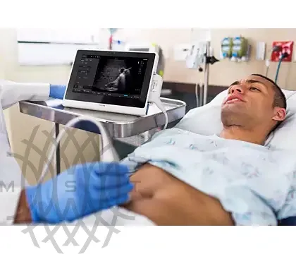 Philips InnoSight ультразвуковой аппарат