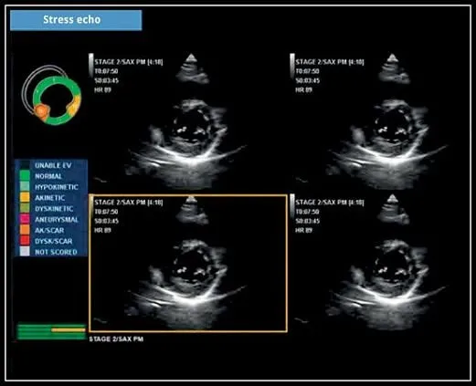 Клинические изображения УЗИ аппарат Esaote MyLab X5