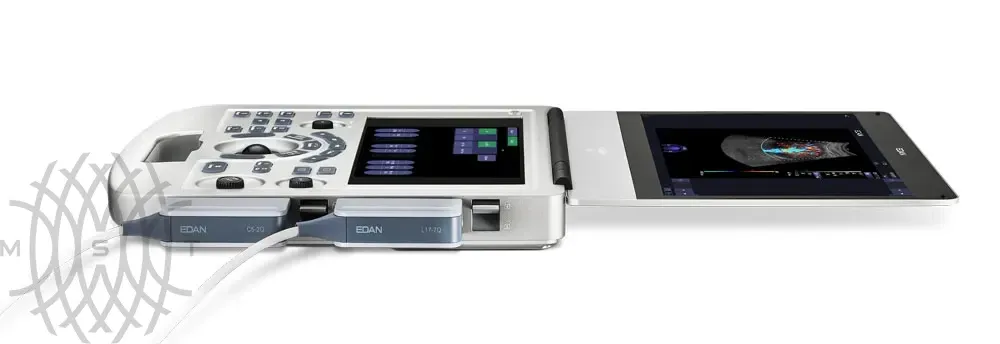 УЗИ аппарат Edan Acclarix AX3