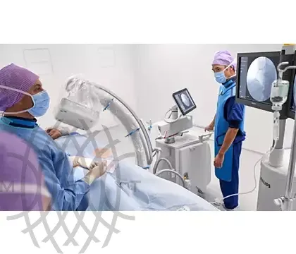 Philips Zenition 70 C-дуга