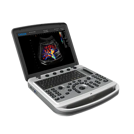 УЗИ аппарат Chison SonoBook 6 портативный