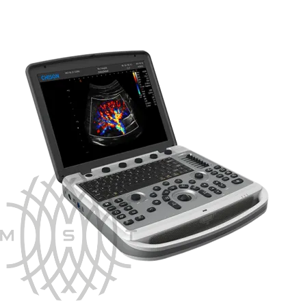 УЗИ аппарат Chison SonoBook 6 портативный