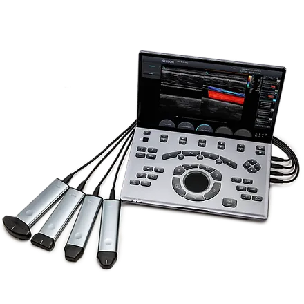 УЗИ аппарат Chison SonoTouch 50 (Sonoair) портативный
