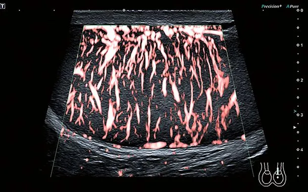 Клинические изображения Canon (Toshiba) Aplio i700 аппарат УЗИ