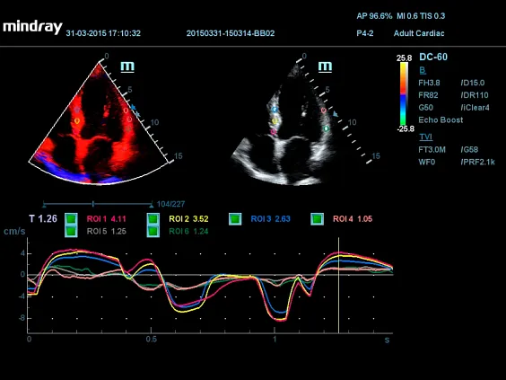 Клинические изображения УЗИ аппарат Mindray DC-55