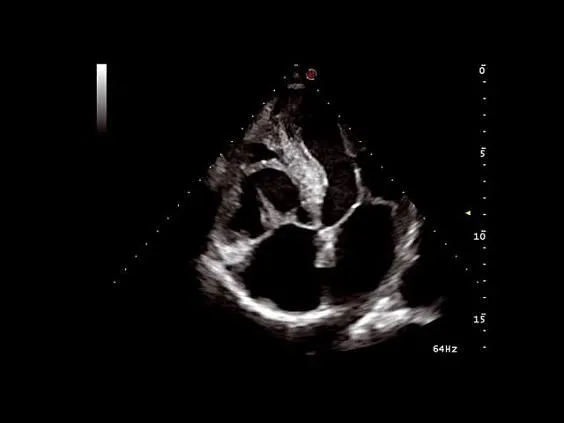 Клинические изображения УЗИ аппарат Esaote MyLab Seven