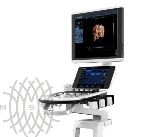 Chison Qbit 6 ультразвуковой аппарат