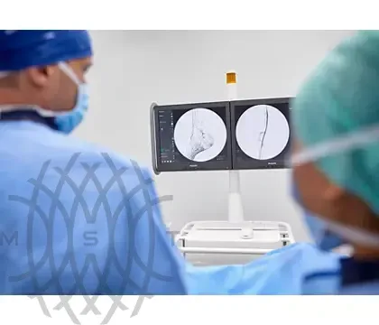 С-дуга Philips Zenition 10