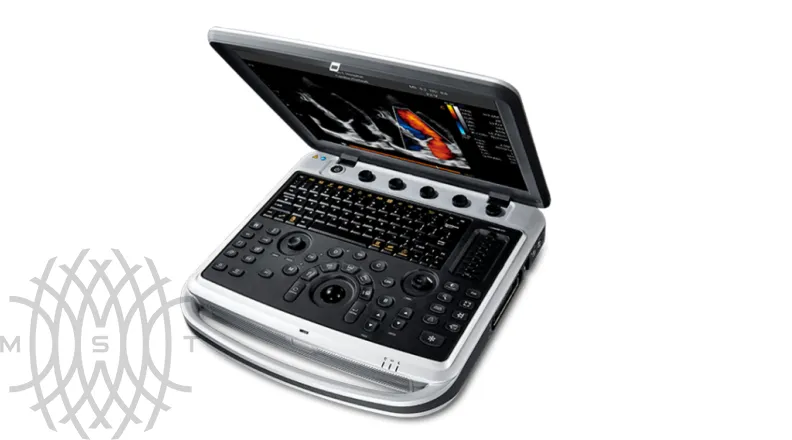 УЗИ аппарат Chison SonoTouch 80 Pro портативный