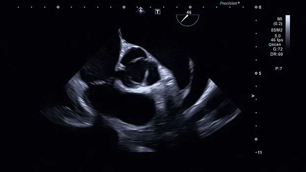 Клинические изображения Canon (Toshiba) Aplio i900 аппарат УЗИ