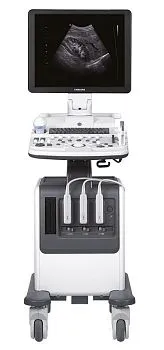 Samsung Medison SonoAce R7 УЗИ аппарат