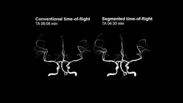 Клинические изображения МРТ аппарат SIEMENS Magnetom Amira 1.5T