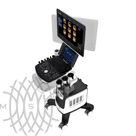 УЗИ аппарат Chison Qbit 11