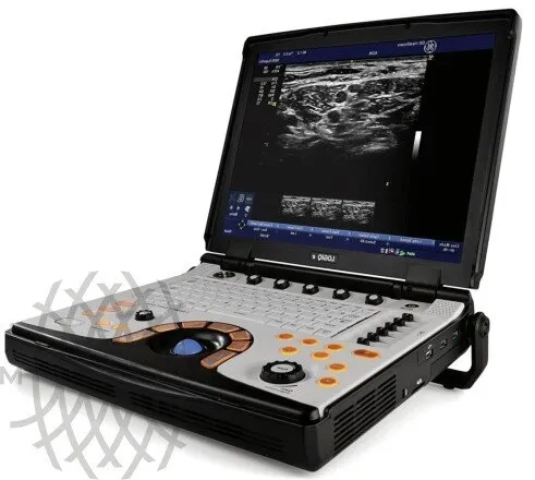 Портативная ультразвуковая система GE HealthCare Logiq e