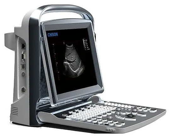 Chison SonoTouch 10 УЗИ аппарат портативный