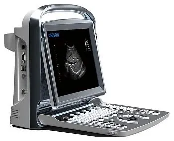 Ультразвуковой аппарат Chison SonoTouch 10