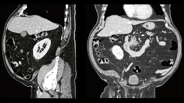 Клинические изображения Siemens SOMATOM go.Up компьютерный томограф