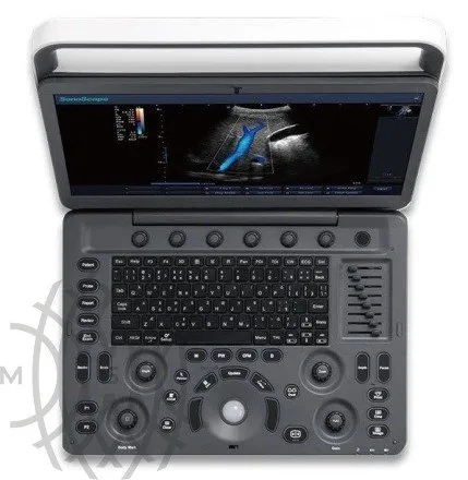 Sonoscape E1 Vet ультразвуковой аппарат