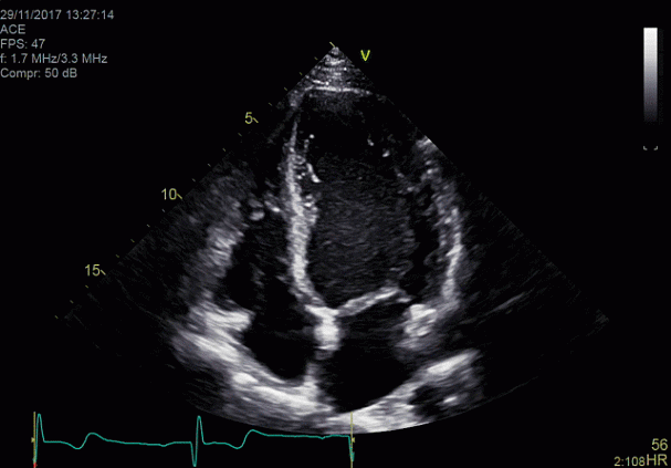 Клинические изображения Ультразвуковая диагностическая система GE HealthCare Vivid E95