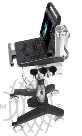 Chison SonoTouch 30 портативный УЗИ аппарат