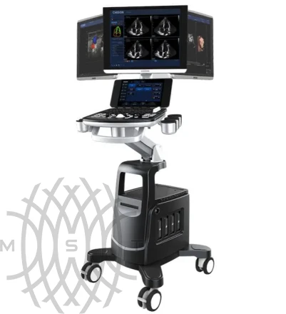 УЗИ аппарат Chison Qbit 10