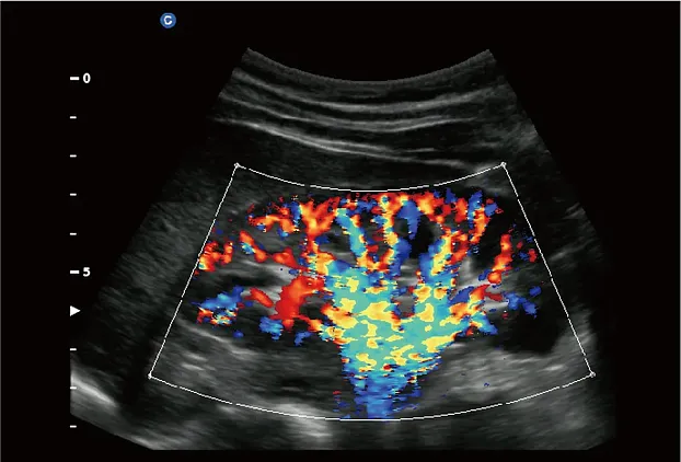 Клинические изображения УЗИ аппарат Chison SonoTouch 60 портативный