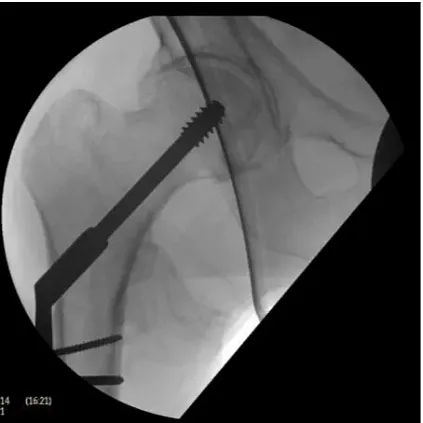 Клинические изображения Philips BV Endura С-дуга