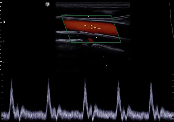 Клинические изображения УЗИ аппарат НПО СКАНЕР РУСКАН 70П портативный