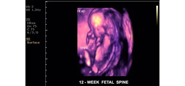 Клинические изображения Philips ClearVue 650 ультразвуковой аппарат