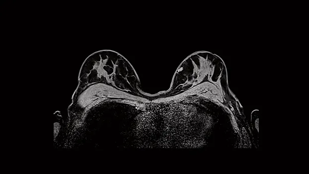 Клинические изображения МРТ аппарат Siemens Magnetom Sola 1,5T