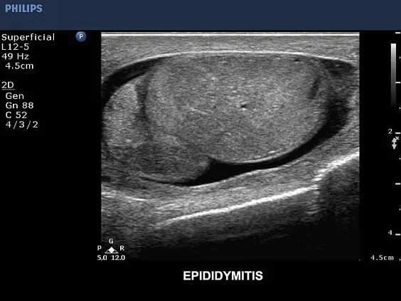 Клинические изображения Philips CX50 ультразвуковой аппарат