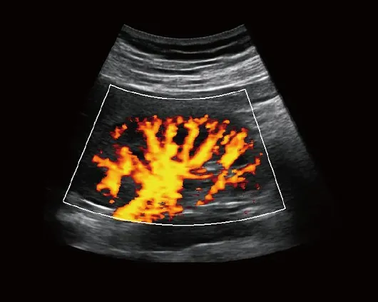 Клинические изображения УЗИ аппарат Chison Qbit 7