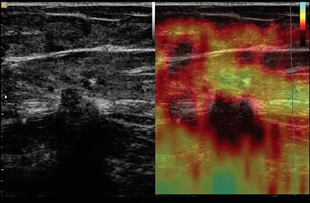 Клинические изображения УЗИ аппарат НПО СКАНЕР РУСКАН 70П портативный