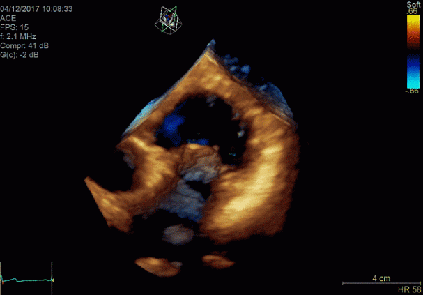 Клинические изображения Ультразвуковая диагностическая система GE HealthCare Vivid E95