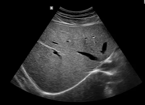 Клинические изображения УЗИ аппарат НПО СКАНЕР РУСКАН 65М