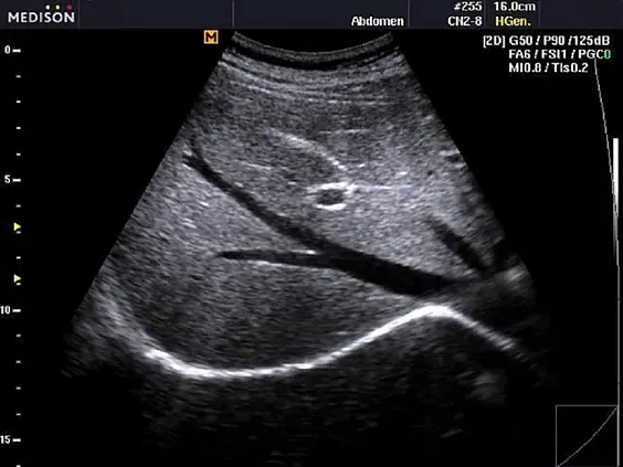 Клинические изображения Samsung Medison EKO 7 УЗИ аппарат