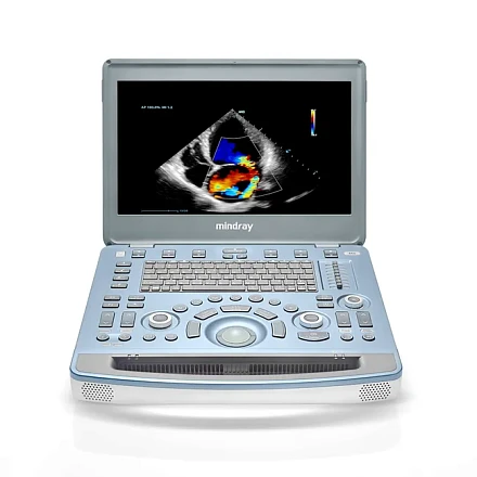 УЗИ аппарат Mindray M8 портативный