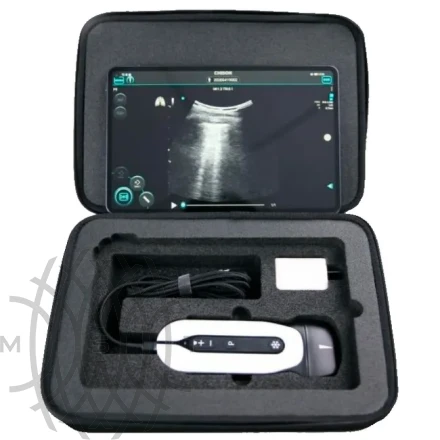 Chison Sonotouch 30 (Sonoeye) портативный УЗИ аппарат