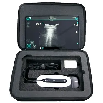 Портативный ультразвуковой аппарат Chison Sonotouch 30 (Sonoeye)