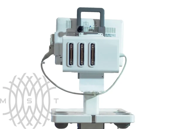 Philips InnoSight ультразвуковой аппарат