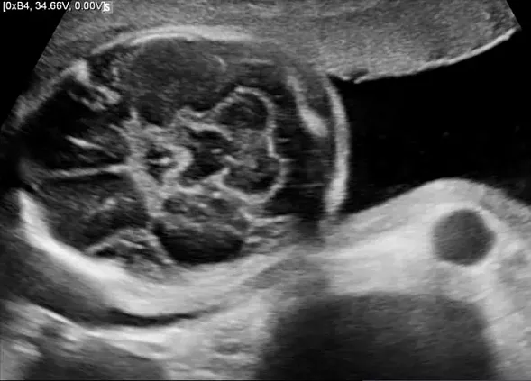 Клинические изображения УЗИ аппарат НПО СКАНЕР РУСКАН 65