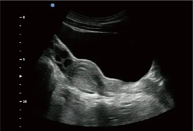 Клинические изображения УЗИ аппарат Chison SonoTouch 60 портативный