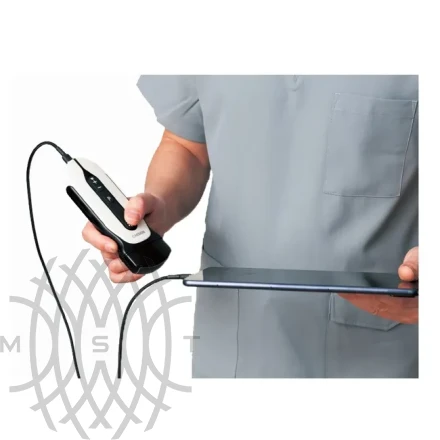 Chison Sonotouch 30 (Sonoeye) портативный УЗИ аппарат