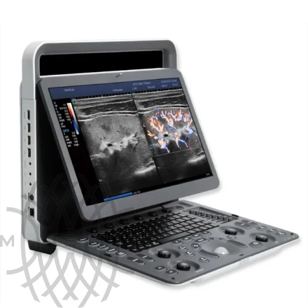 Sonoscape E2 ультразвуковой аппарат